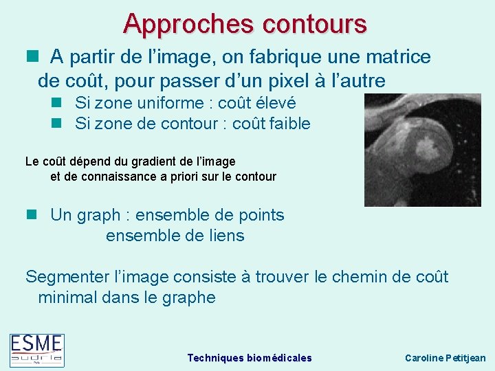 Approches contours A partir de l’image, on fabrique une matrice de coût, pour passer