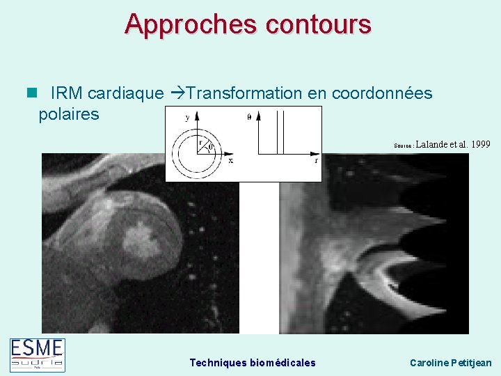 Approches contours IRM cardiaque Transformation en coordonnées polaires Source : Techniques biomédicales Lalande et