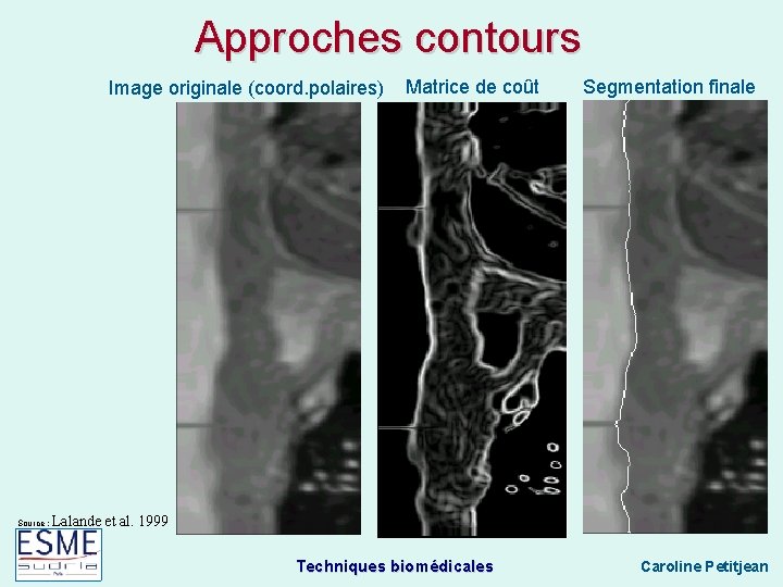 Approches contours Image originale (coord. polaires) Source : Matrice de coût Segmentation finale Lalande