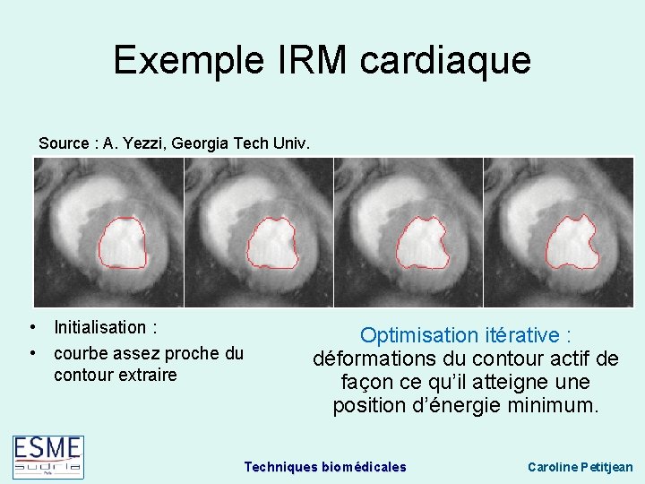 Exemple IRM cardiaque Source : A. Yezzi, Georgia Tech Univ. • Initialisation : •