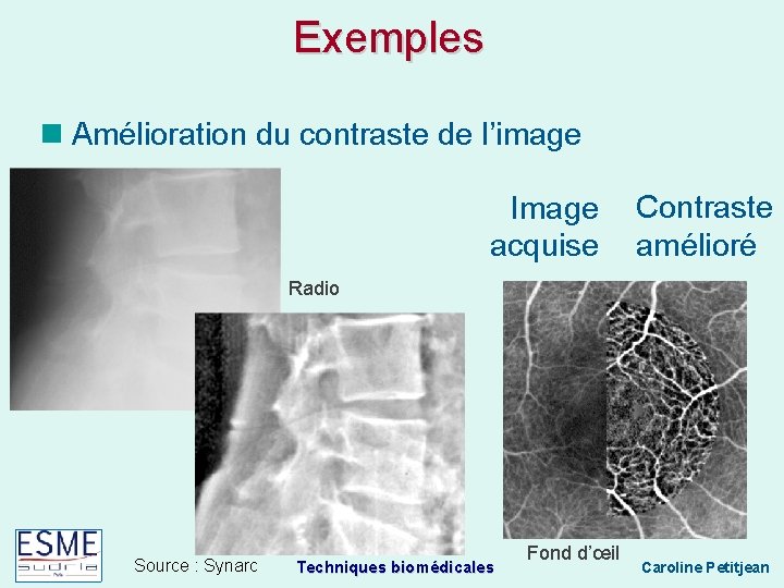 Exemples Amélioration du contraste de l’image Image acquise Contraste amélioré Radio Source : Synarc