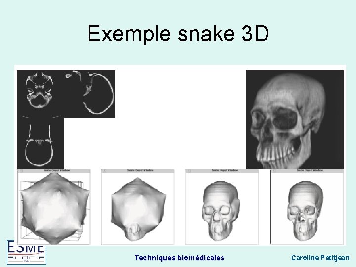 Exemple snake 3 D Techniques biomédicales Caroline Petitjean 