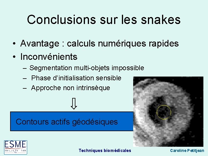 Conclusions sur les snakes • Avantage : calculs numériques rapides • Inconvénients – Segmentation
