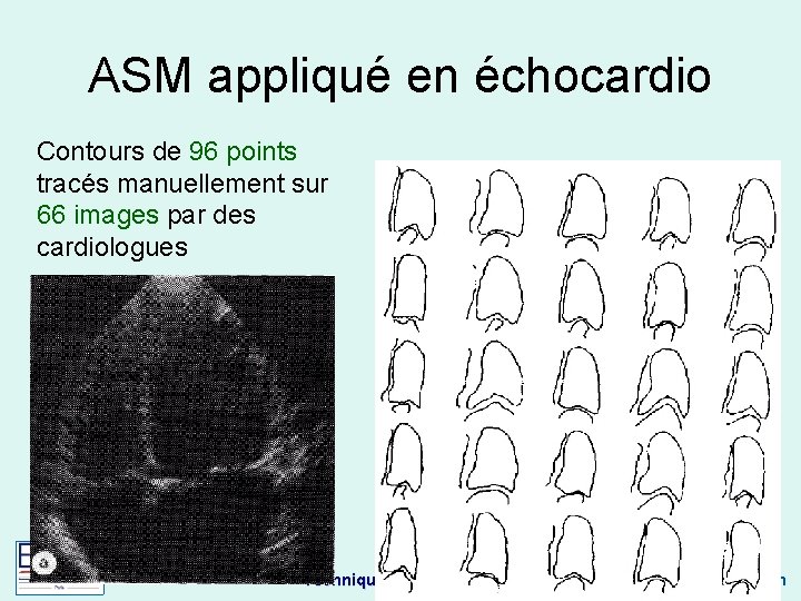 ASM appliqué en échocardio Contours de 96 points tracés manuellement sur 66 images par