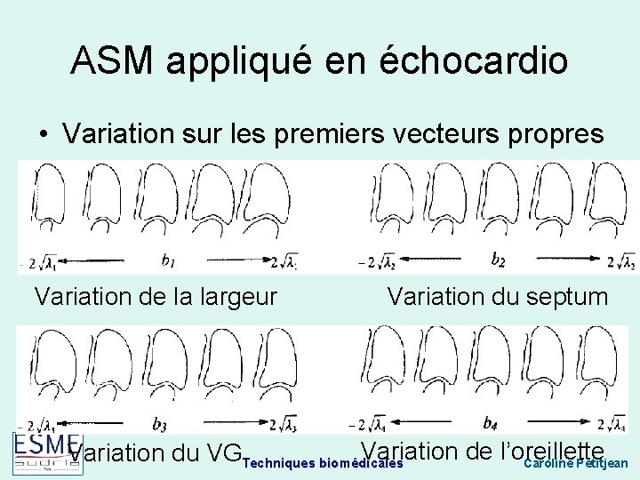 ASM appliqué en échocardio • Variation sur les premiers vecteurs propres Variation de la