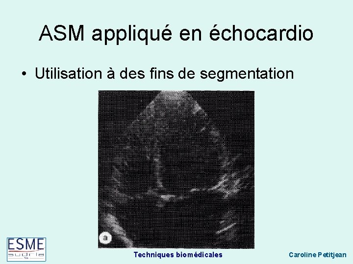 ASM appliqué en échocardio • Utilisation à des fins de segmentation Techniques biomédicales Caroline
