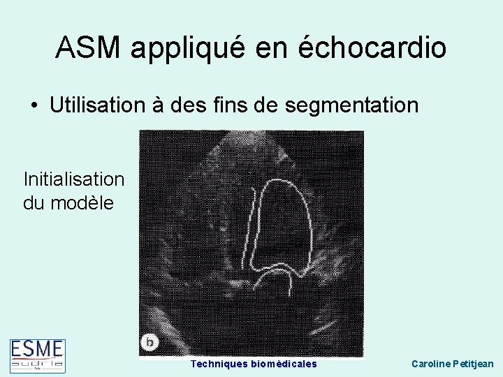 ASM appliqué en échocardio • Utilisation à des fins de segmentation Initialisation du modèle