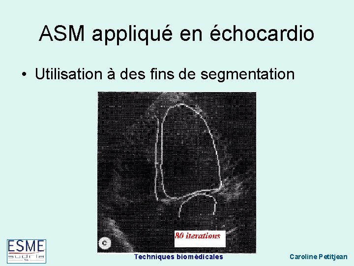 ASM appliqué en échocardio • Utilisation à des fins de segmentation Techniques biomédicales Caroline