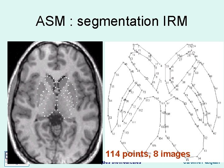 ASM : segmentation IRM 114 points, 8 images Techniques biomédicales Caroline Petitjean 
