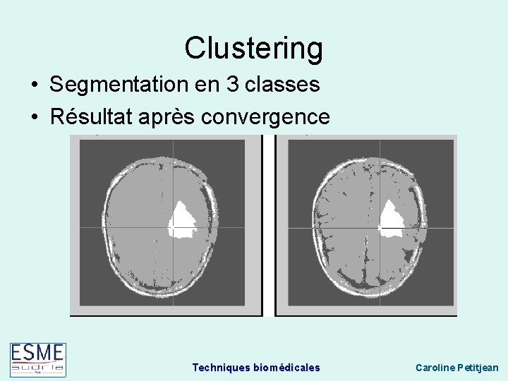 Clustering • Segmentation en 3 classes • Résultat après convergence Techniques biomédicales Caroline Petitjean