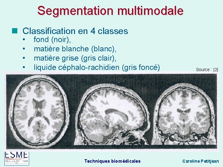 Segmentation multimodale Classification en 4 classes • • fond (noir), matière blanche (blanc), matière