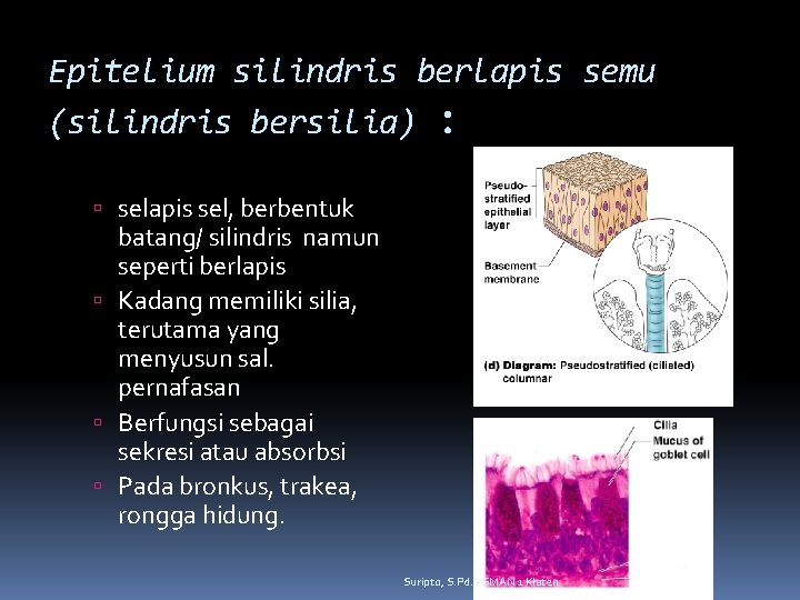 Epitelium silindris berlapis semu (silindris bersilia) : selapis sel, berbentuk batang/ silindris namun seperti