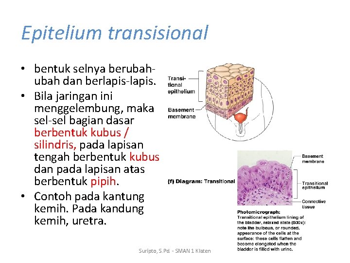Epitelium transisional • bentuk selnya berubah dan berlapis-lapis. • Bila jaringan ini menggelembung, maka