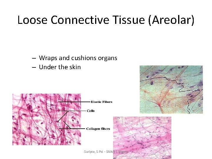 Loose Connective Tissue (Areolar) – Wraps and cushions organs – Under the skin Suripto,