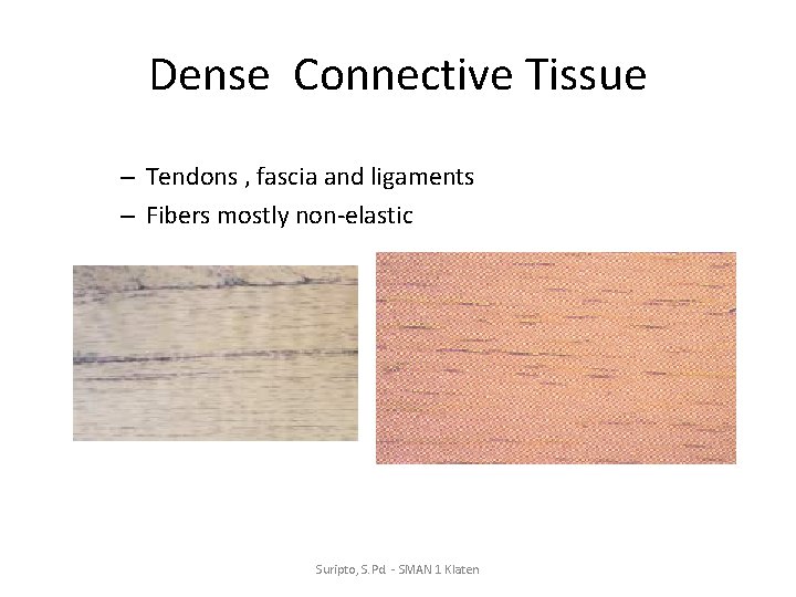 Dense Connective Tissue – Tendons , fascia and ligaments – Fibers mostly non-elastic Suripto,