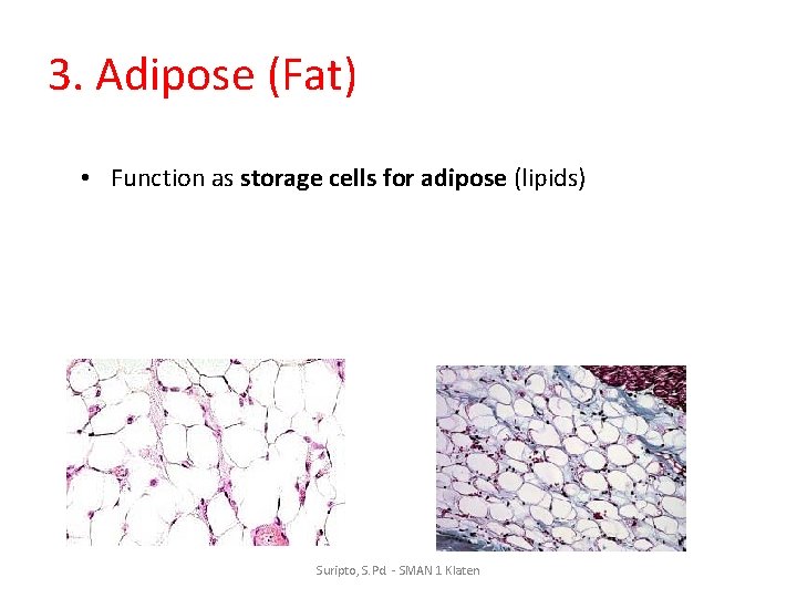 3. Adipose (Fat) • Function as storage cells for adipose (lipids) Suripto, S. Pd.