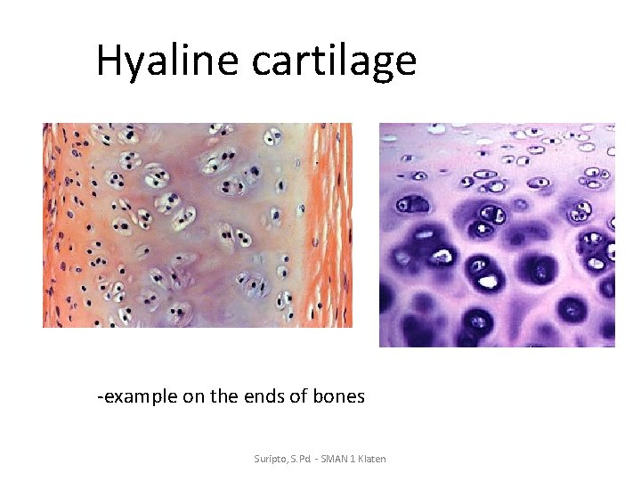 Hyaline cartilage -example on the ends of bones Suripto, S. Pd. - SMAN 1