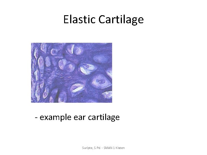 Elastic Cartilage - example ear cartilage Suripto, S. Pd. - SMAN 1 Klaten 