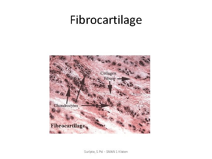 Fibrocartilage Suripto, S. Pd. - SMAN 1 Klaten 