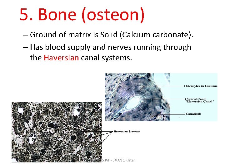 5. Bone (osteon) – Ground of matrix is Solid (Calcium carbonate). – Has blood