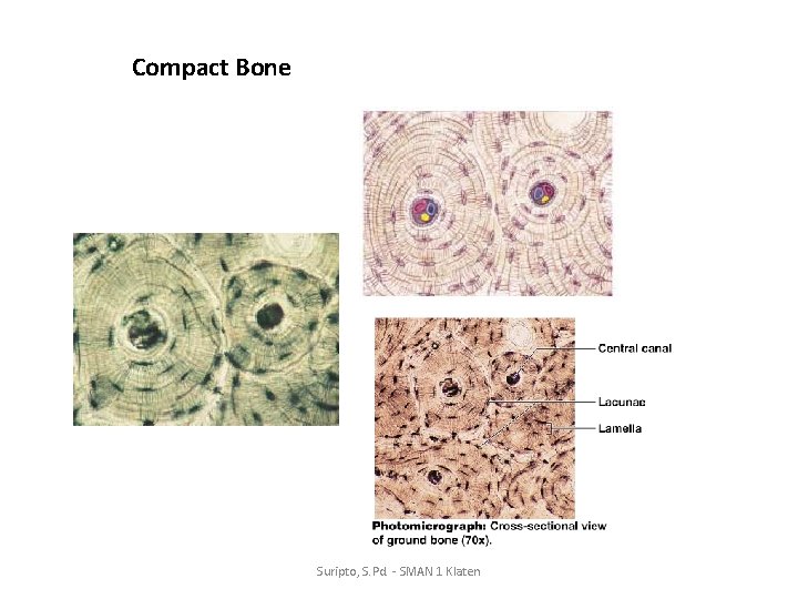 Compact Bone Suripto, S. Pd. - SMAN 1 Klaten 