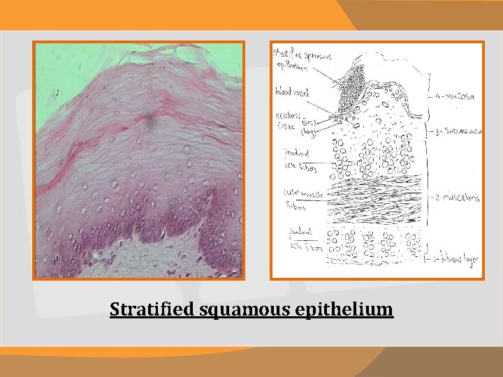 Stratified squamous epithelium 