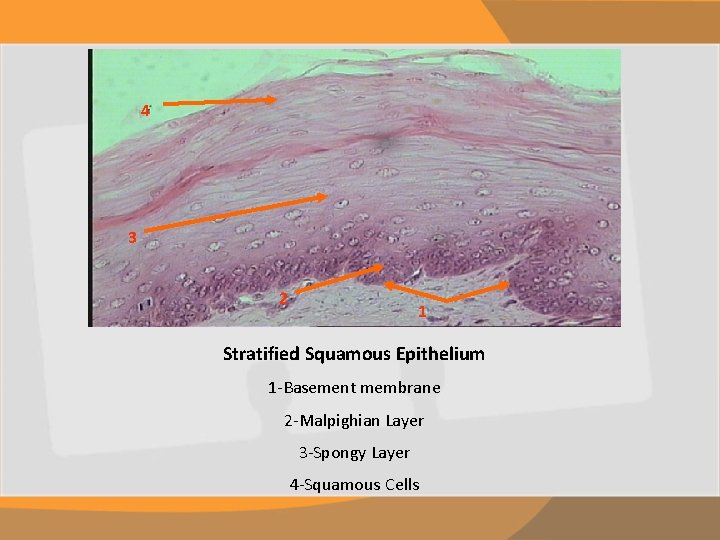 4 3 2 1 Stratified Squamous Epithelium 1 -Basement membrane 2 -Malpighian Layer 3