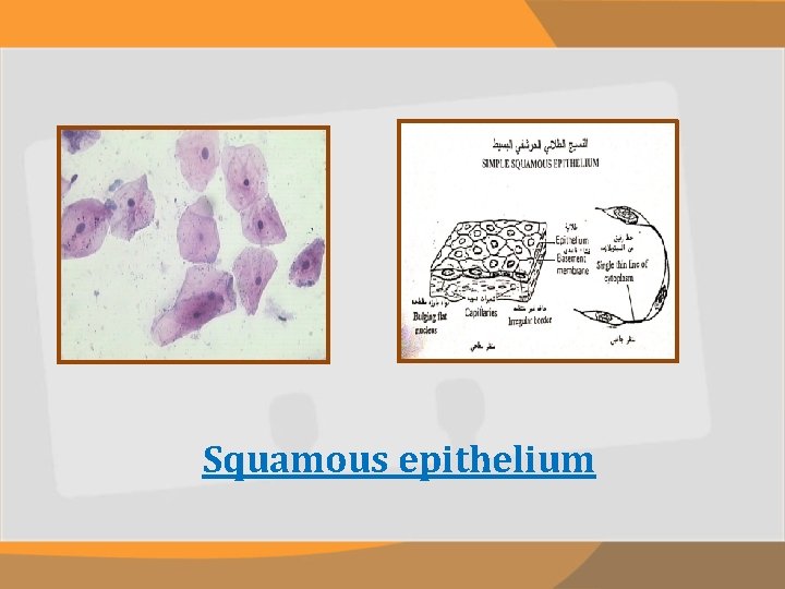 Squamous epithelium 