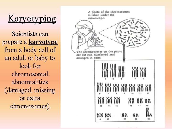 Karyotyping Scientists can prepare a karyotype from a body cell of an adult or