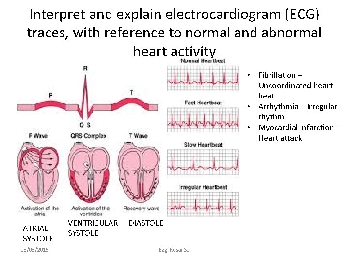 Interpret and explain electrocardiogram (ECG) traces, with reference to normal and abnormal heart activity