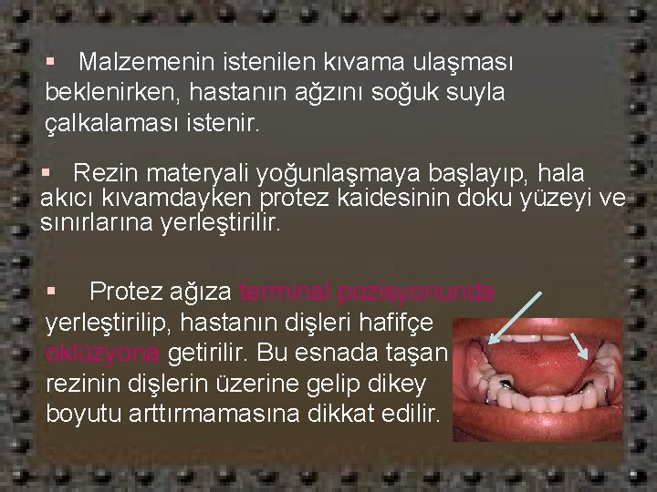 § Malzemenin istenilen kıvama ulaşması beklenirken, hastanın ağzını soğuk suyla çalkalaması istenir. § Rezin