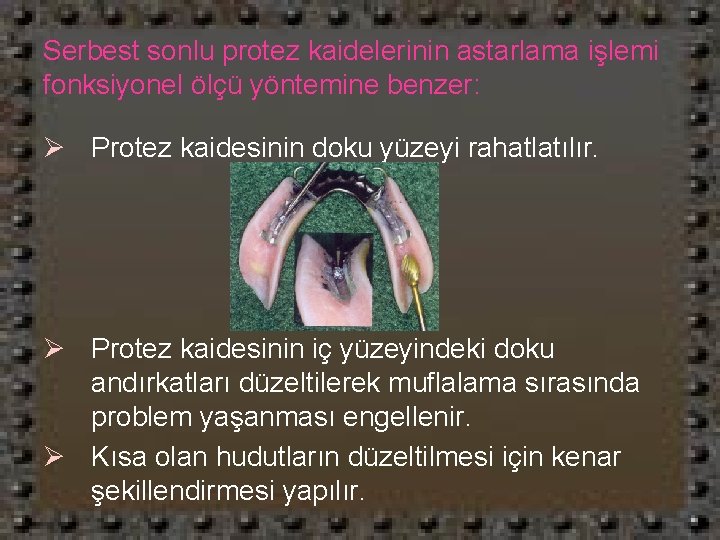 Serbest sonlu protez kaidelerinin astarlama işlemi fonksiyonel ölçü yöntemine benzer: Ø Protez kaidesinin doku