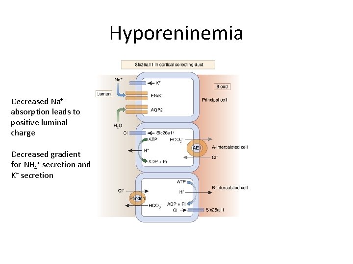 Hyporeninemia Decreased Na+ absorption leads to positive luminal charge Decreased gradient for NH 4+