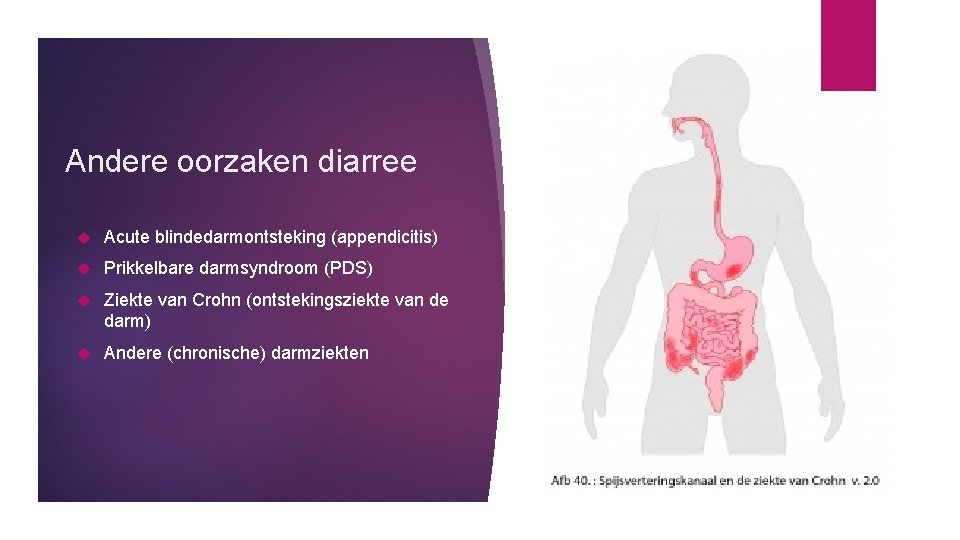 Andere oorzaken diarree Acute blindedarmontsteking (appendicitis) Prikkelbare darmsyndroom (PDS) Ziekte van Crohn (ontstekingsziekte van