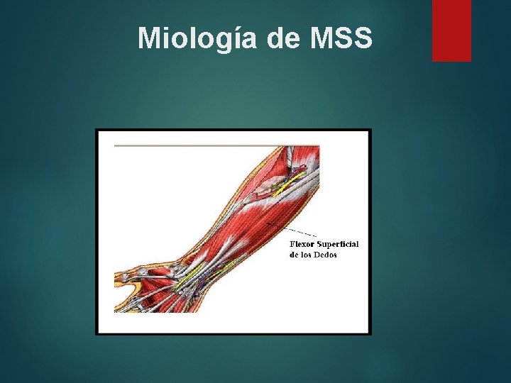 Miología de MSS 