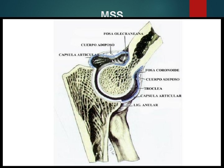 MSS 