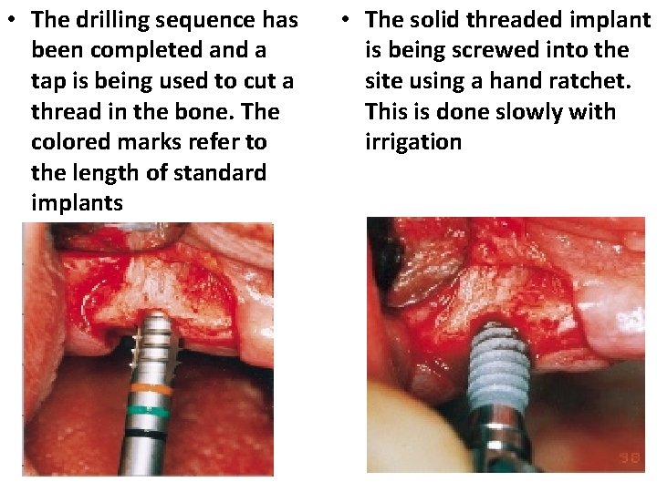  • The drilling sequence has been completed and a tap is being used