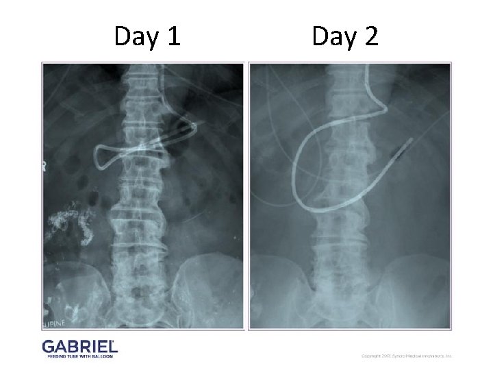 Day 1 Day 2 