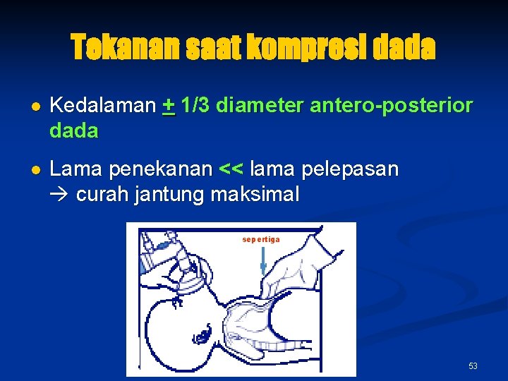 Tekanan saat kompresi dada l Kedalaman + 1/3 diameter antero-posterior dada l Lama penekanan