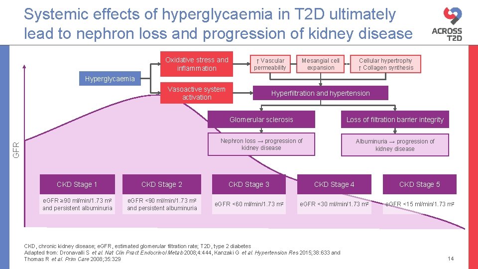 Systemic effects of hyperglycaemia in T 2 D ultimately lead to nephron loss and