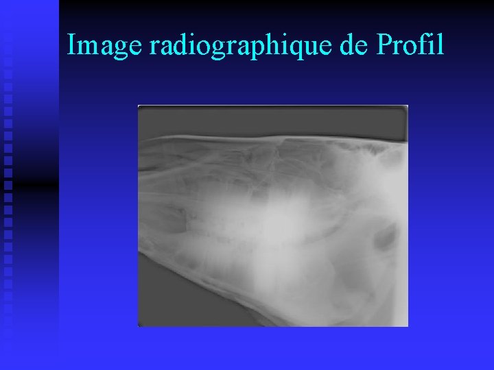 Image radiographique de Profil 