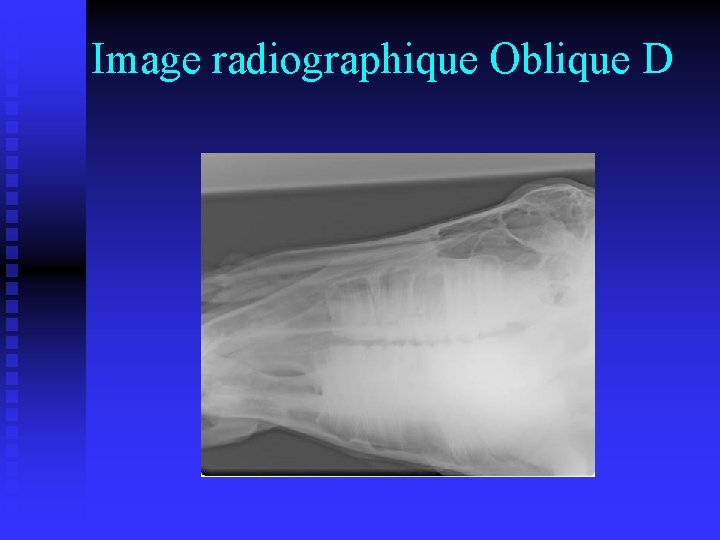 Image radiographique Oblique D 