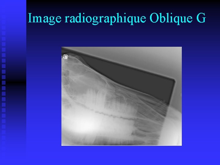 Image radiographique Oblique G 