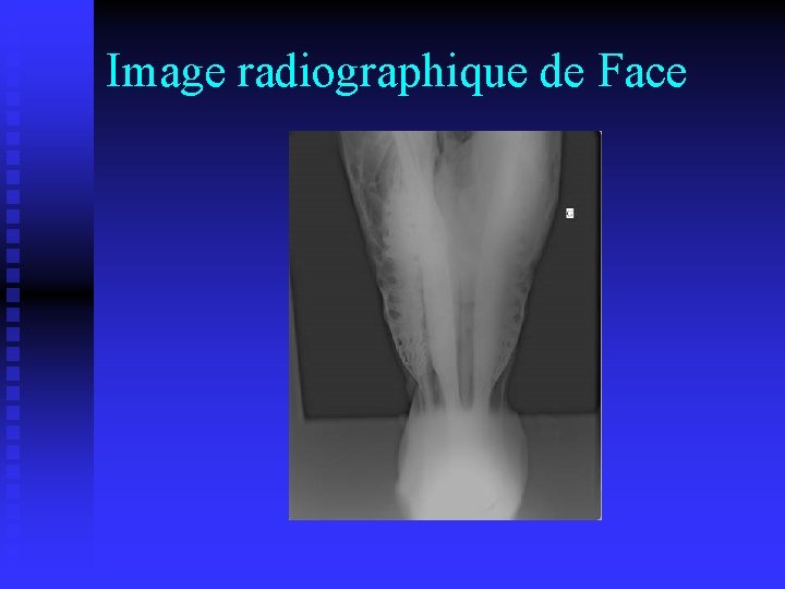 Image radiographique de Face 