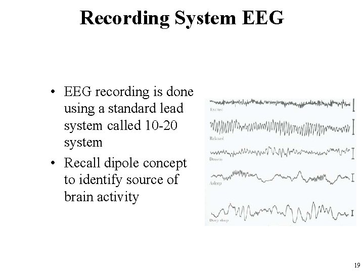 Recording System EEG • EEG recording is done using a standard lead system called