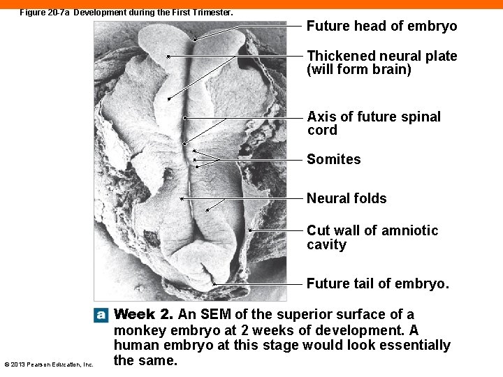 Figure 20 -7 a Development during the First Trimester. Future head of embryo Thickened