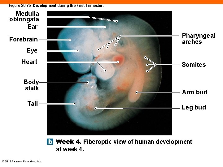 Figure 20 -7 b Development during the First Trimester. Medulla oblongata Ear Forebrain Pharyngeal