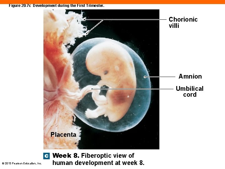 Figure 20 -7 c Development during the First Trimester. Chorionic villi Amnion Umbilical cord