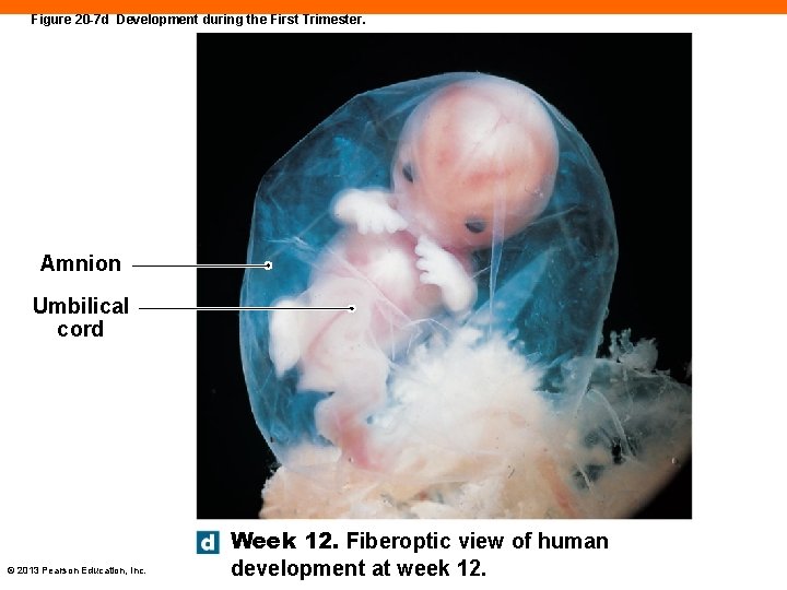 Figure 20 -7 d Development during the First Trimester. Amnion Umbilical cord © 2013