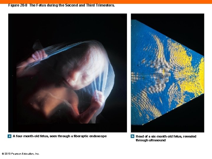 Figure 20 -8 The Fetus during the Second and Third Trimesters. A four-month-old fetus,